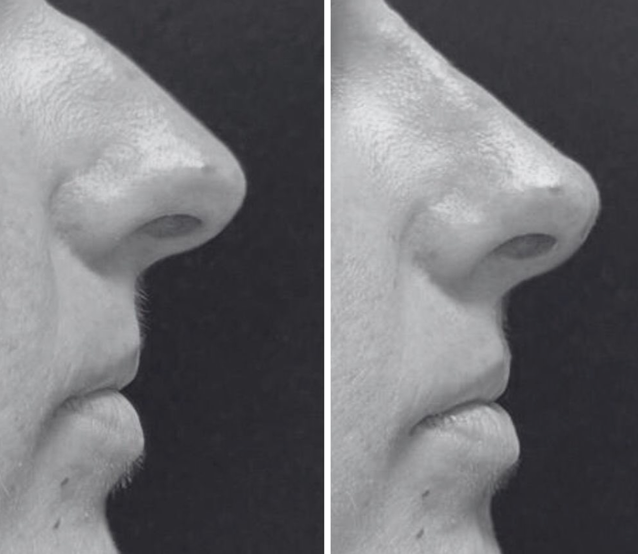 tratamientos de belleza